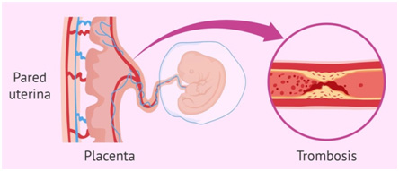 pared uterina